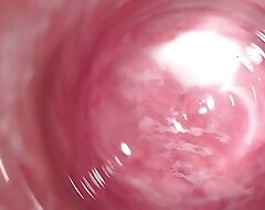 Internal Camera abysm inner Mia's creamy pussy, Welcome to my vagina