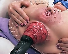 Choicest overwhelming prolapse scene! cervix, fisting, max widen